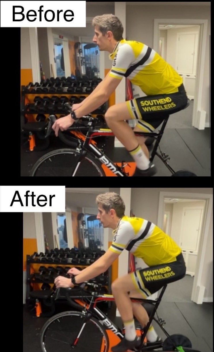 Before and After Bikefit